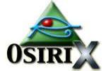 OsiriX logo
