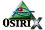 Go to OsiriX OsiriX logo